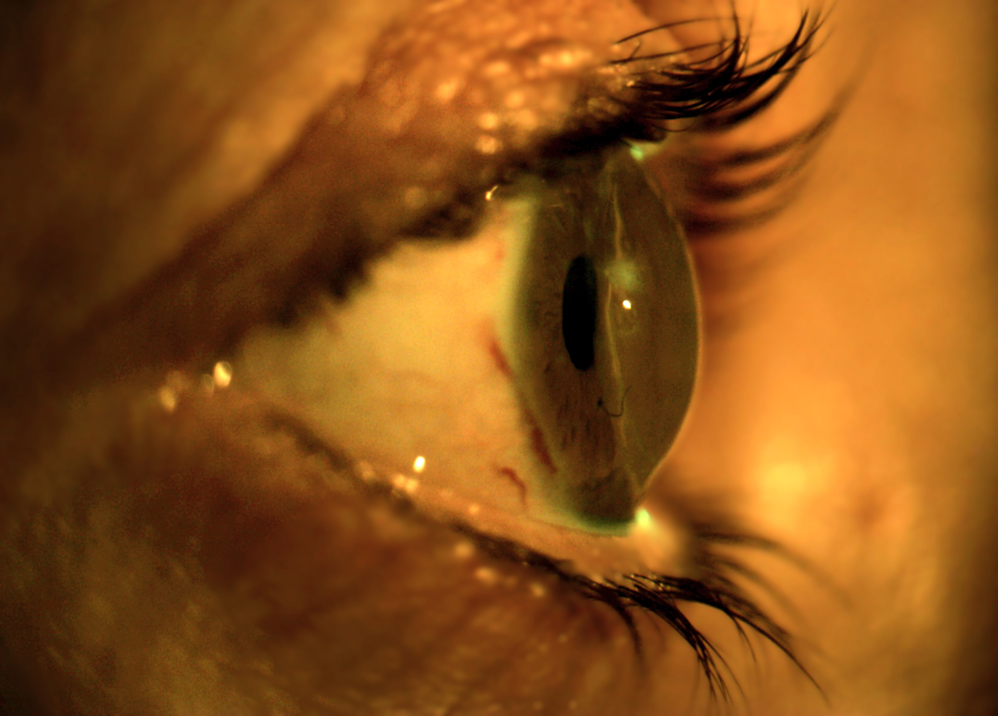 Orduna e-Learning y Cione revelan los ganadores del Concurso de Fotografía para Ópticos-Optometristas